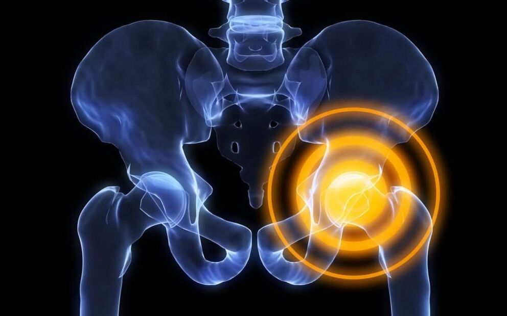 pain in the hip joint Figure 2
