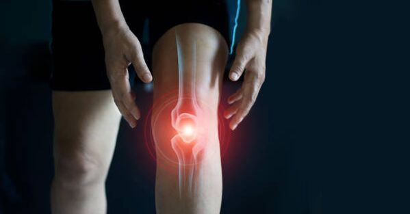 Artrosis of knee joint